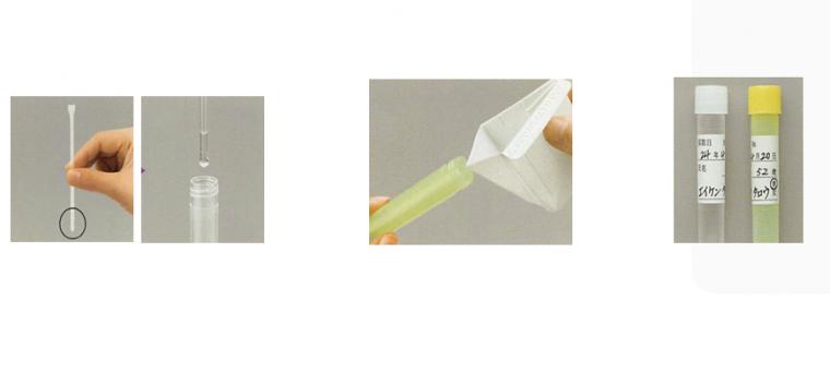 国民皆歯科健診の時代へ 唾液測定と予防歯科がつくる「次の10年の歯科医療」