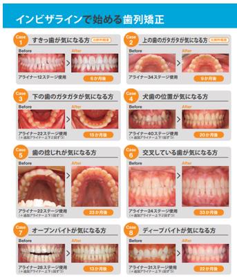 マウスピース矯正と歯科医院経営の“本当の話” 患者様にも知ってほしい、歯科医師としての私の視点