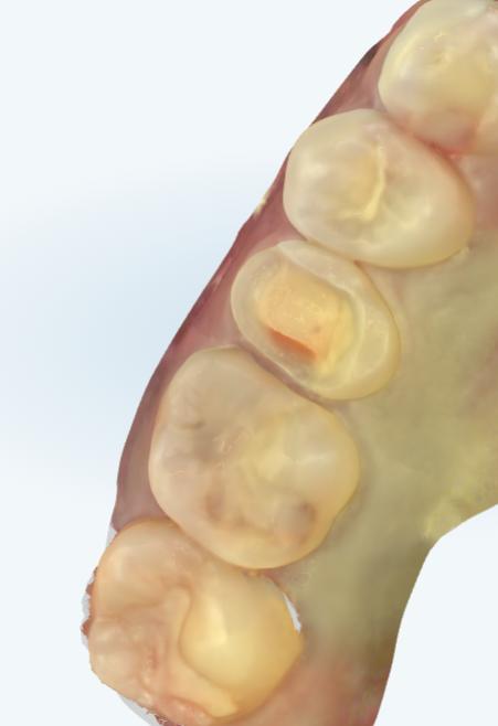 セラミック治療の正解 なぜ「2日に1回」執刀する歯科医師の形成は、ここまで美しいのか