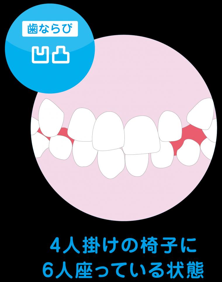 プレオルソ装置の使い方。選択方法。 マスタークラス