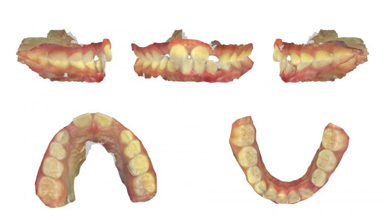 1年3ヶ月の変化。