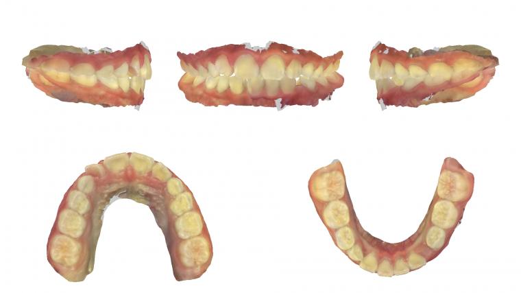 1年3ヶ月の変化。
