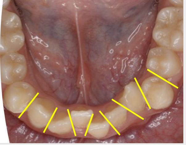 IPRは、どのタイミングで行うの？