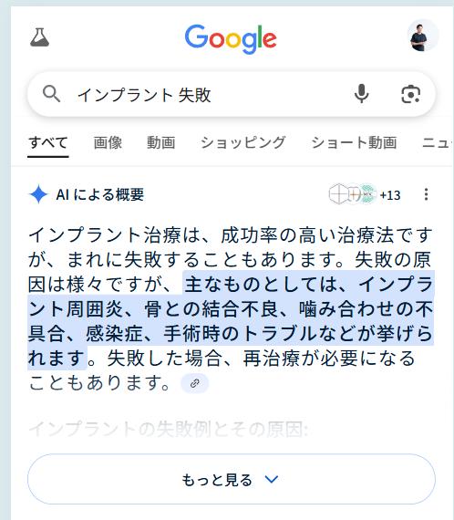 インプラントで失敗する人の共通点|後悔しないために“今”知っておくべきこと