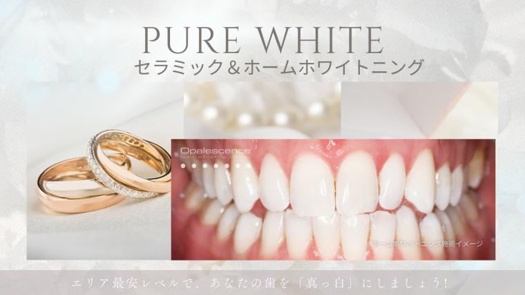 池袋の歯医者さん みんなの矯正歯科・こども歯科クリニック: PURE WHITEキャンペーンのご案内